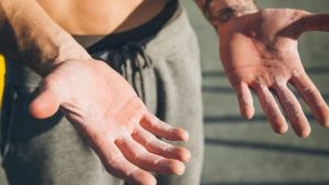 How To Prevent Gym Calluses