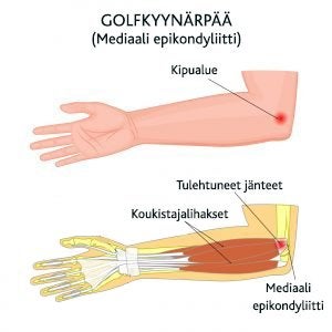 Golfkyynärpää Mediaali epikondylitti Myprotein