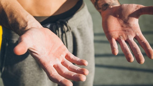 How To Prevent Gym Calluses