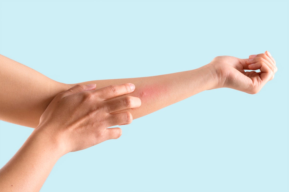 A woman touches a ingrown hair on her arm | Venus UK