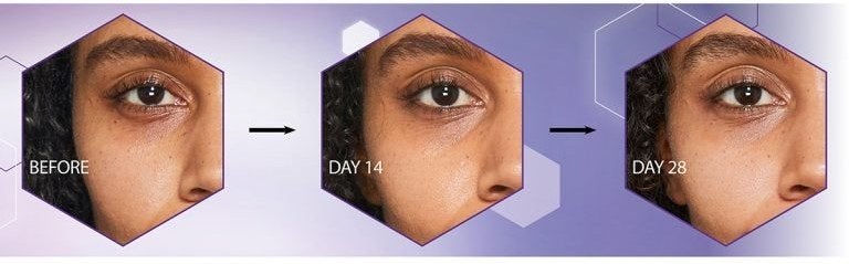 An image showing the results that No7 Pure Retinol 0.3% Complex Night Concentrate can have on the eye area within 28 days